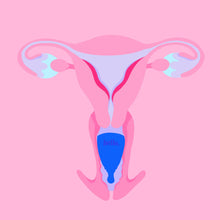 Load image into Gallery viewer, Hello Cup - High Cervix Award-Winning Menstrual Cup
